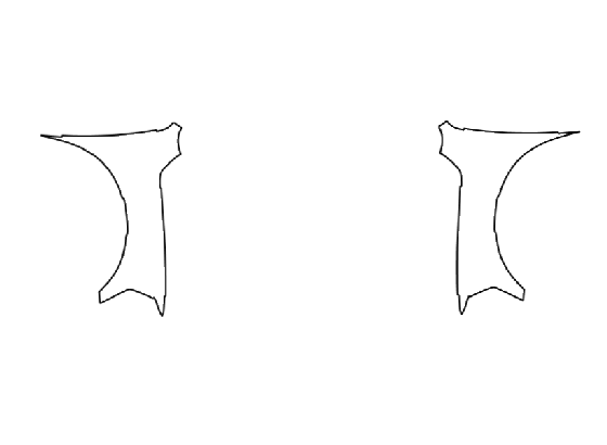 Full Fender Kit | RAM 2500 REBEL 2025