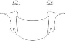 Full Hood & Fender + Mirror Kit | CHEVROLET TRAVERSE 2023