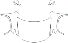 Full Hood & Fender + Mirror Kit | CHEVROLET TRAVERSE 2019